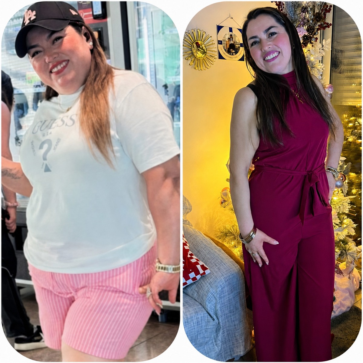Before and after gastric sleeve surgery results at Central Hospital – visible weight loss
