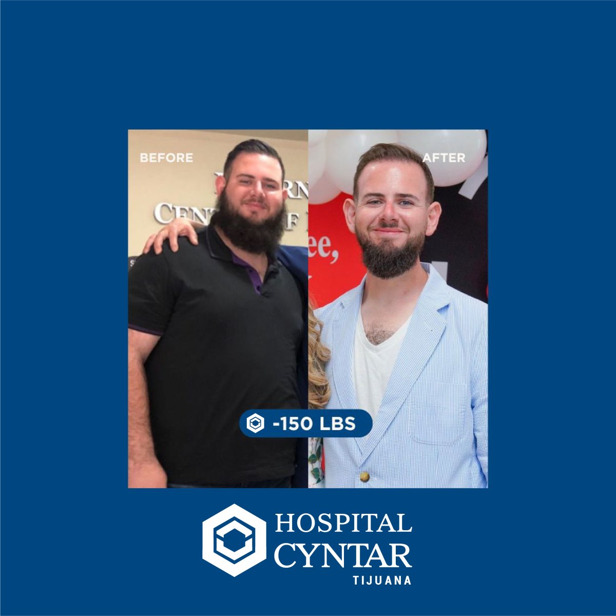 Resultados antes y después de manga gástrica en HOSPITAL CYNTAR TIJUANA, -68 kg