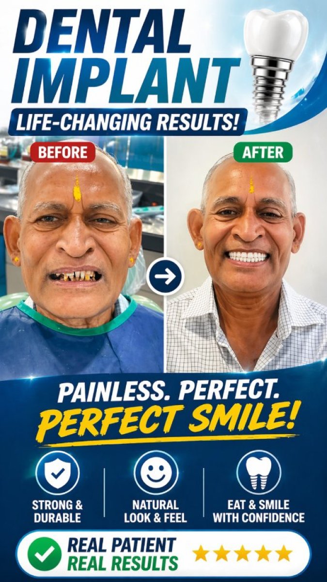 Before and after dental implant results – restored smile and natural teeth appearance