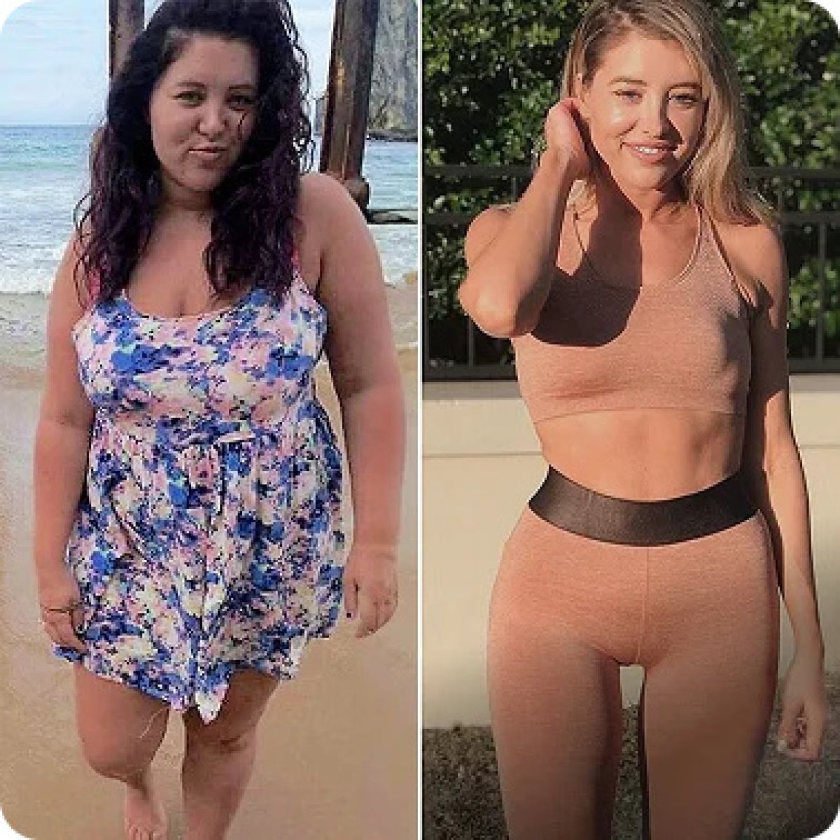 Before and after gastric sleeve surgery results – significant weight loss transformation