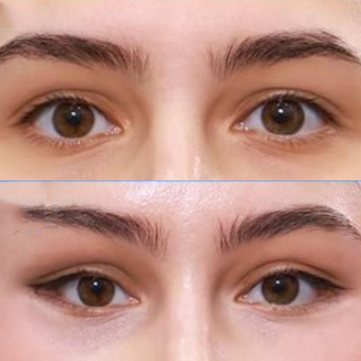Before and after Fox Eye Lift results at Returning Plastic Surgery, enhanced eye contour