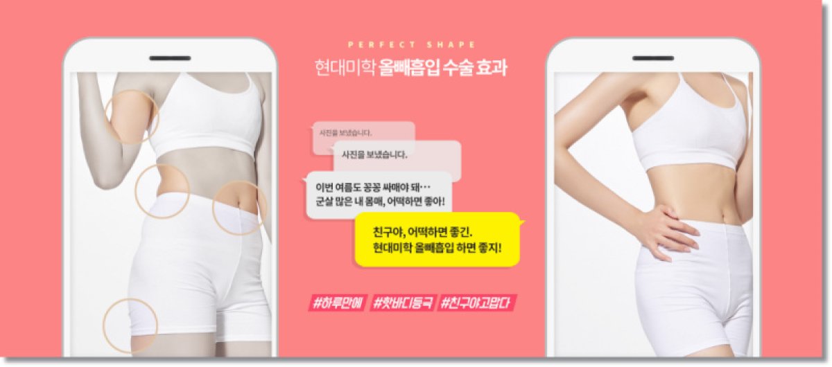 Before and after tummy tuck results – visible waist and abdomen contour improvement
