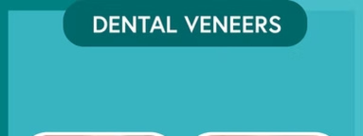 Resultados antes y después de carillas dentales: sonrisa mejorada y dientes más blancos