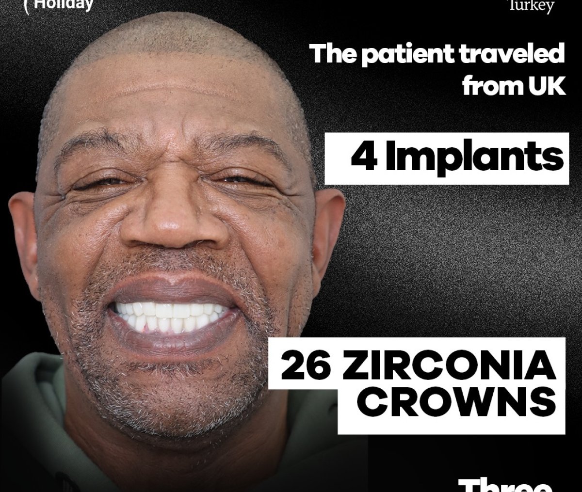 Smile makeover result after 4 implants and 26 zirconia crowns for UK patient in Turkey