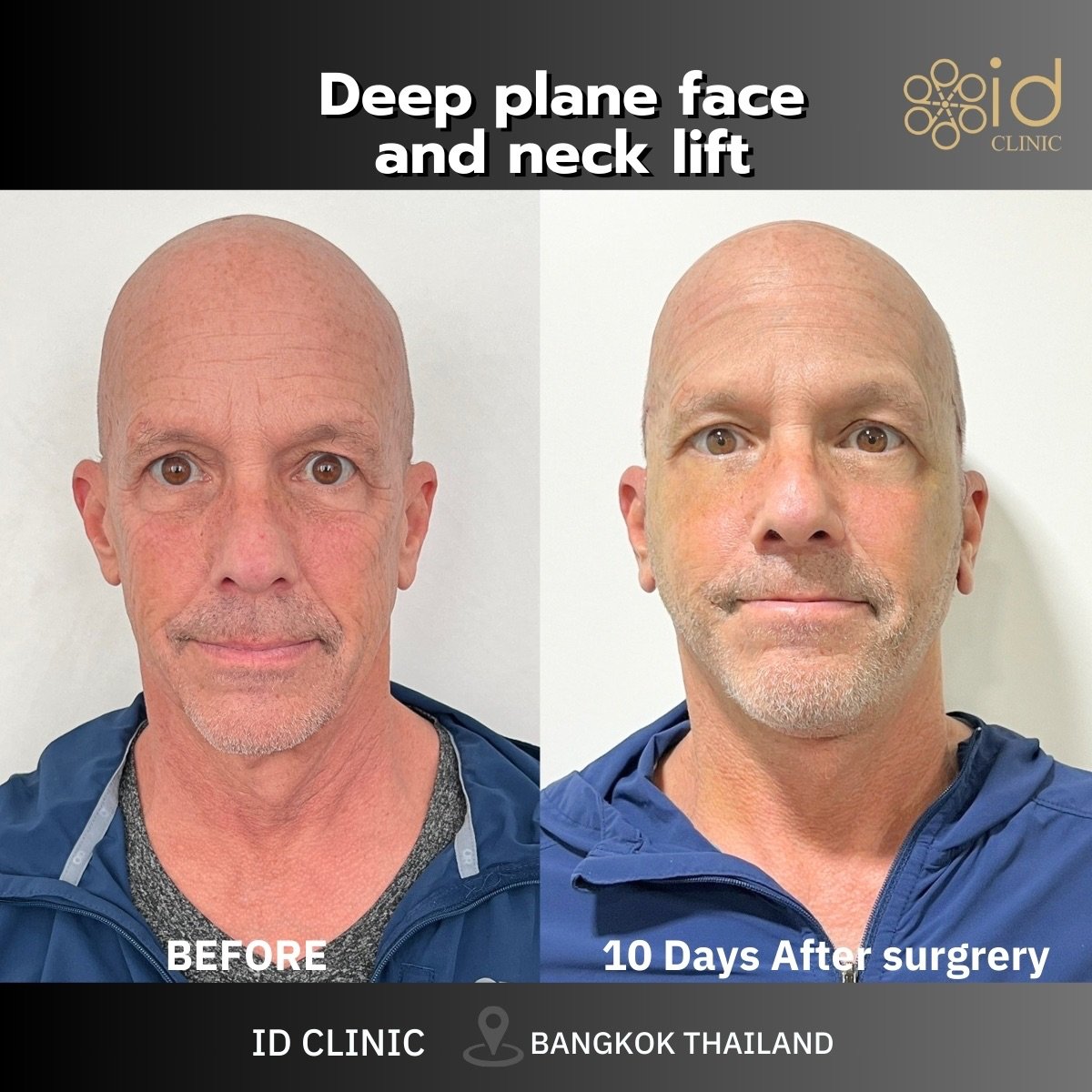 before and after photo