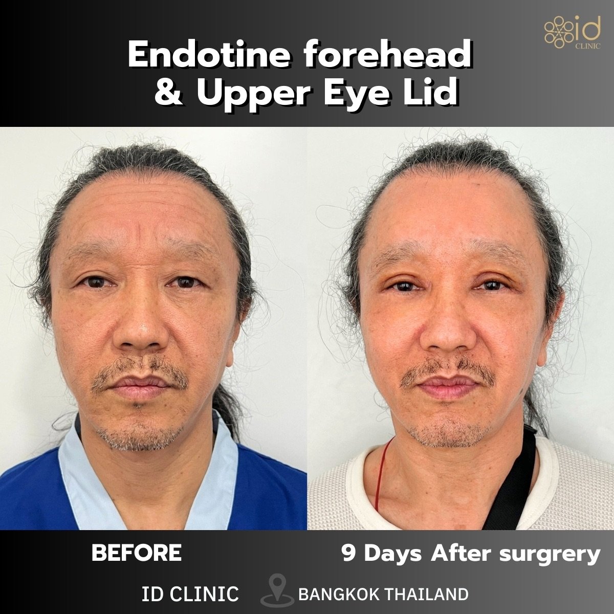 before and after photo