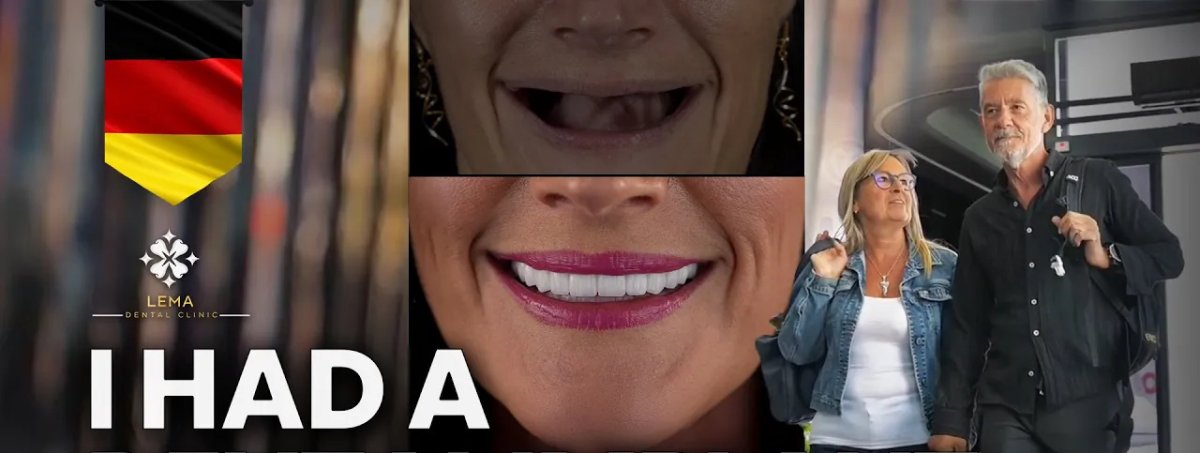 Результати до і після імплантації зубів у Lema Dental Clinic – відновлення усмішки