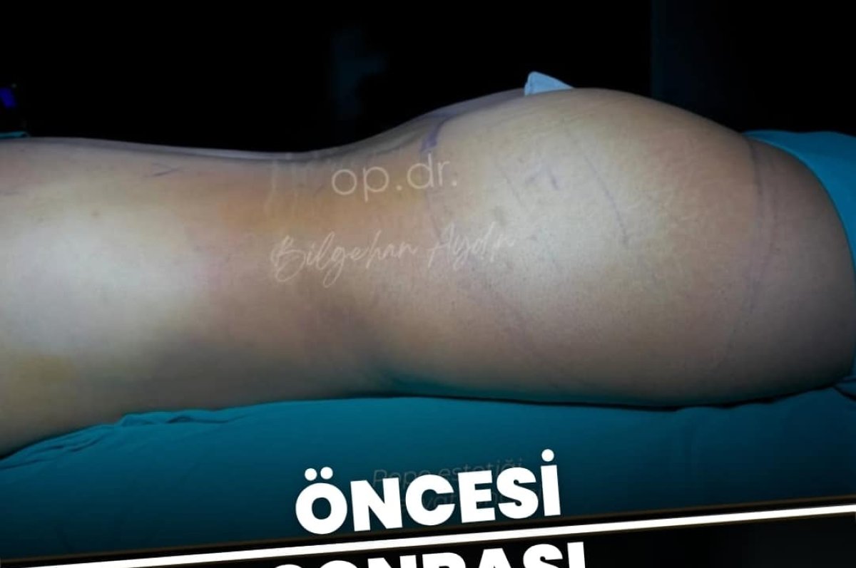 photo #1