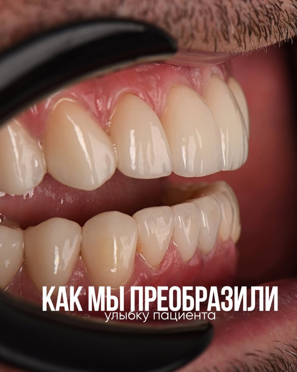 photo #1