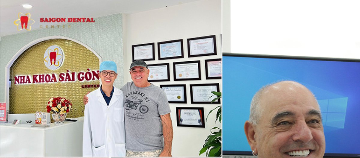 نتائج زراعة الأسنان في SAIGON CENTER DENTAL CLINIC – ابتسامة محسنة بعد الإجراء