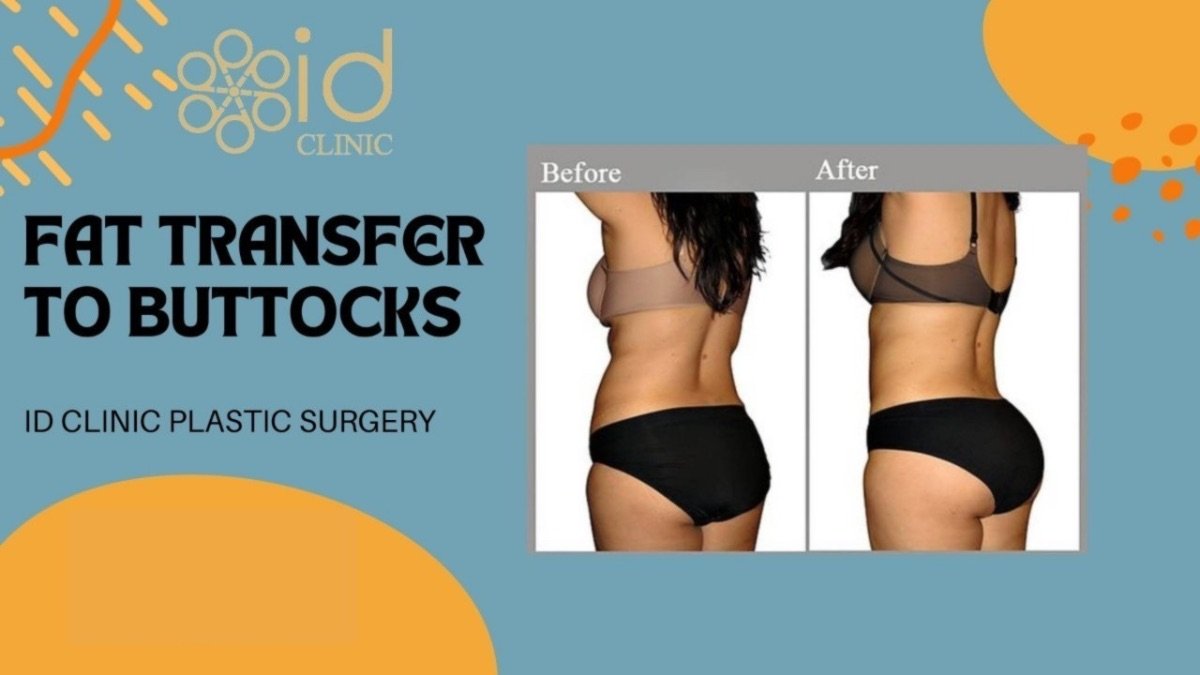 Before and after Brazilian Butt Lift results at ID Clinic Bangkok, enhanced buttock contour