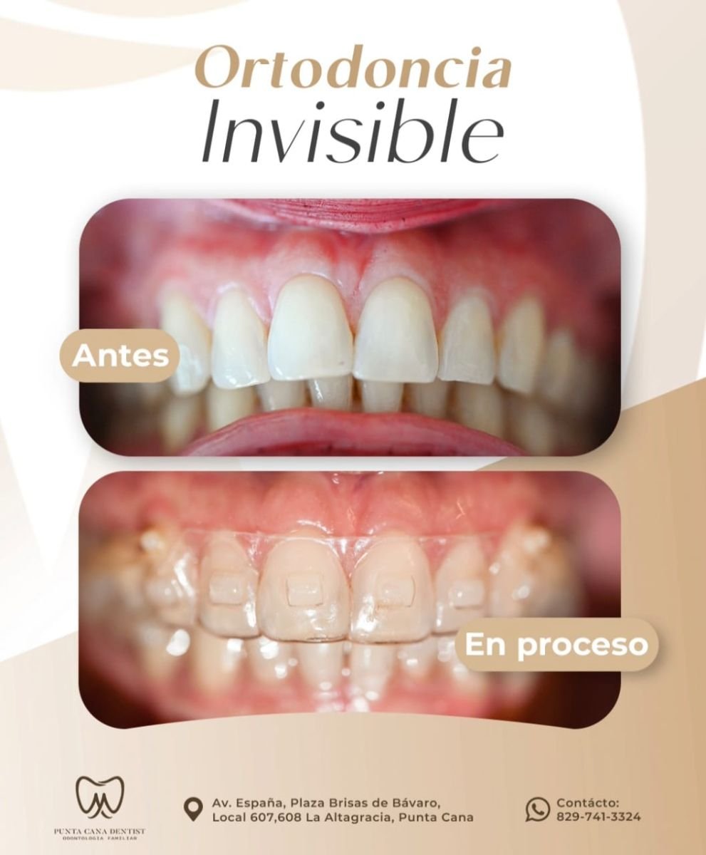 photo #1