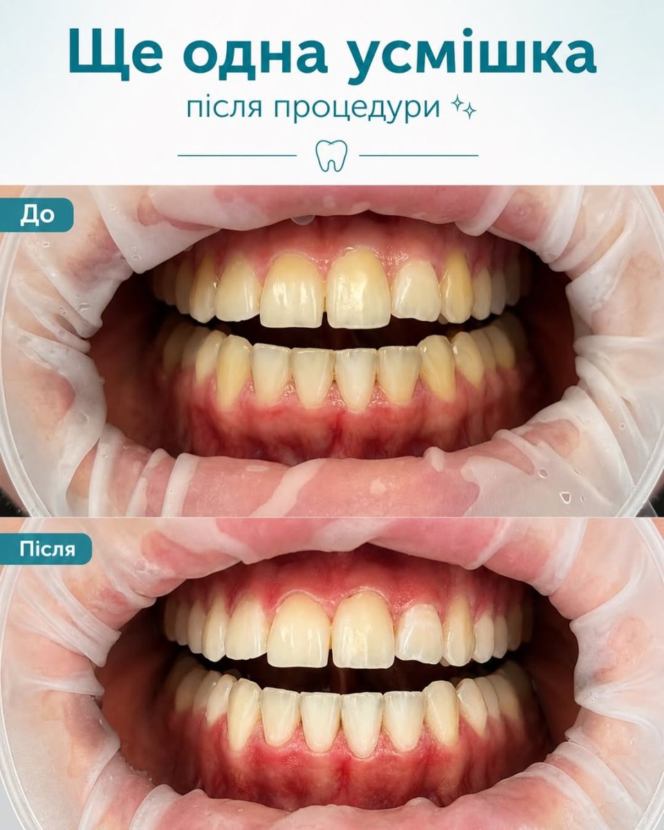 photo #1