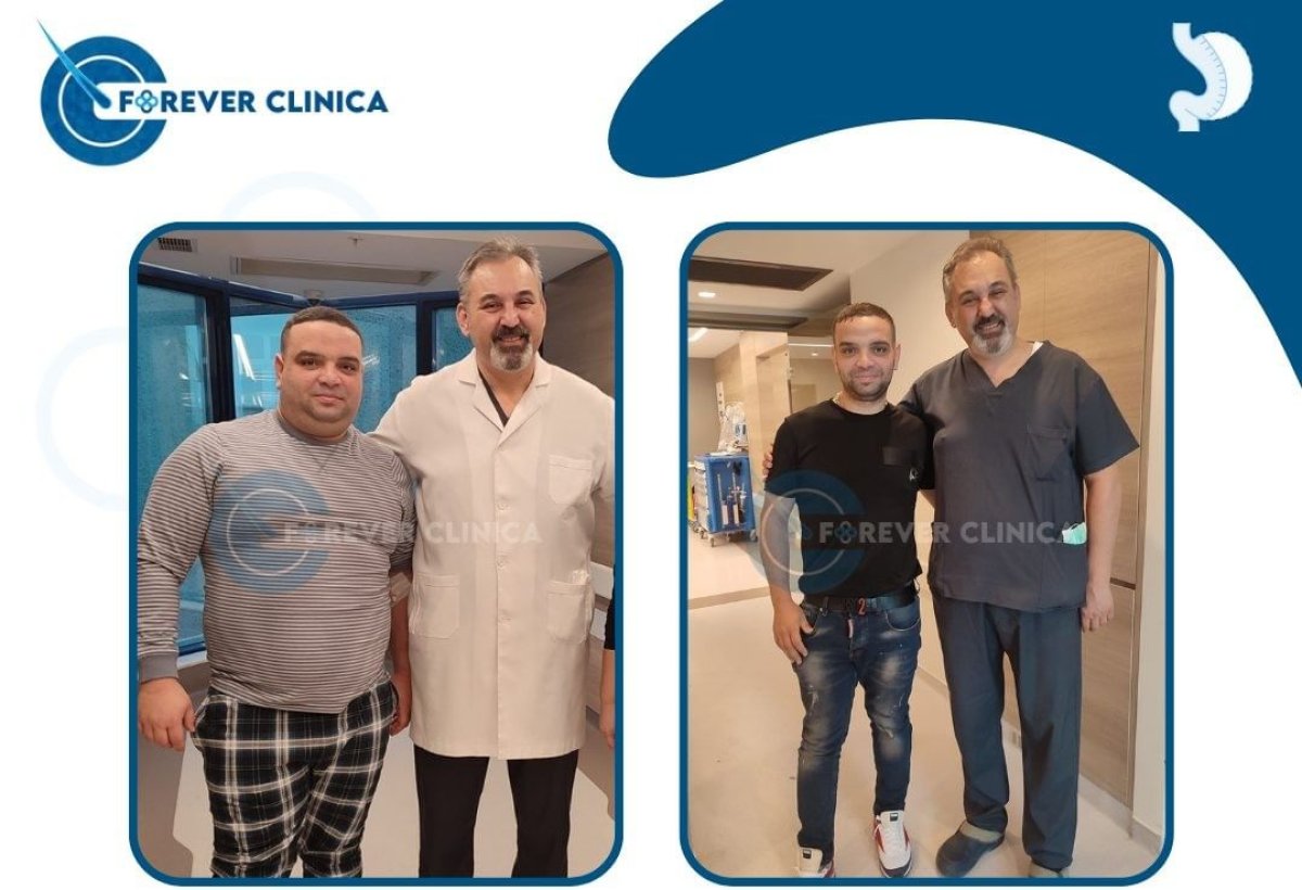 نتائج قبل وبعد تكميم المعدة في Forever Clinica – فقدان وزن ملحوظ