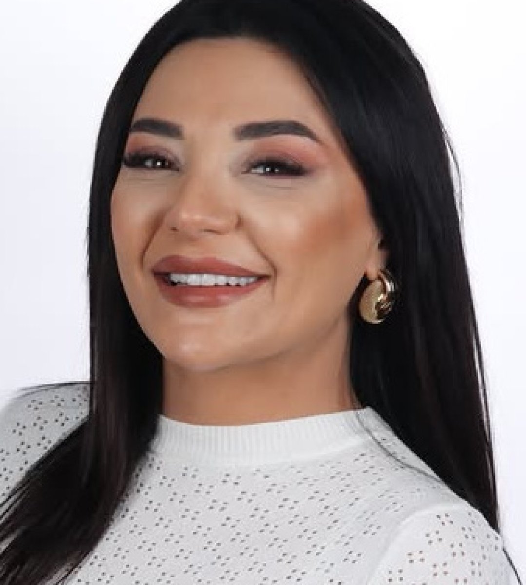 Efekt metamorfozy uśmiechu w aesthedental Dental Clinic – poprawa dzięki licówkom
