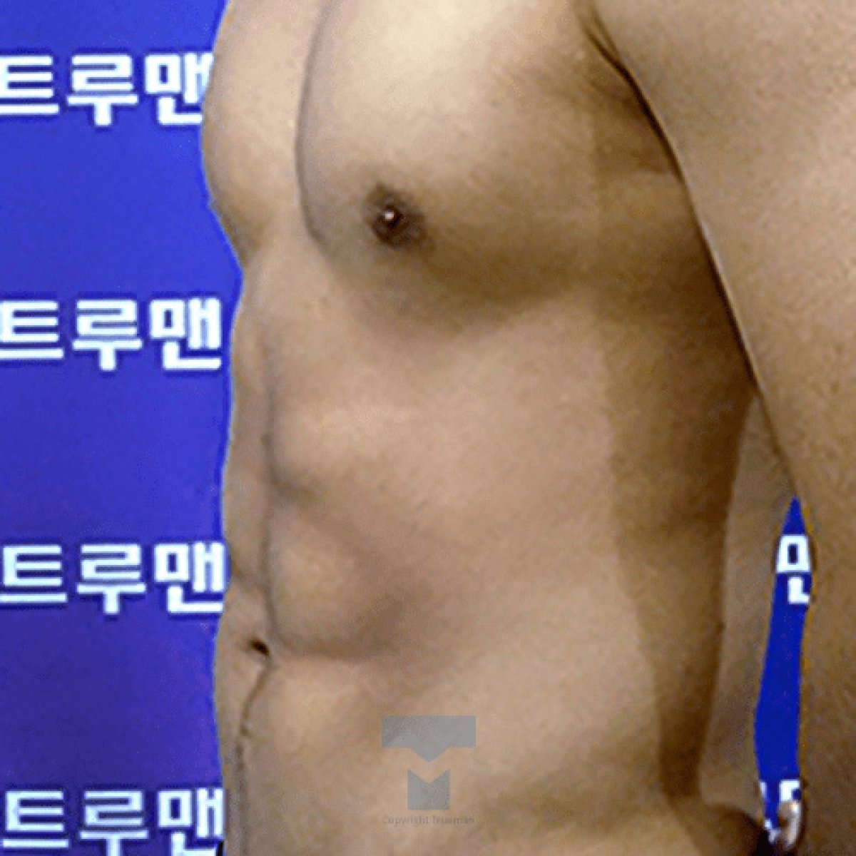 photo #1