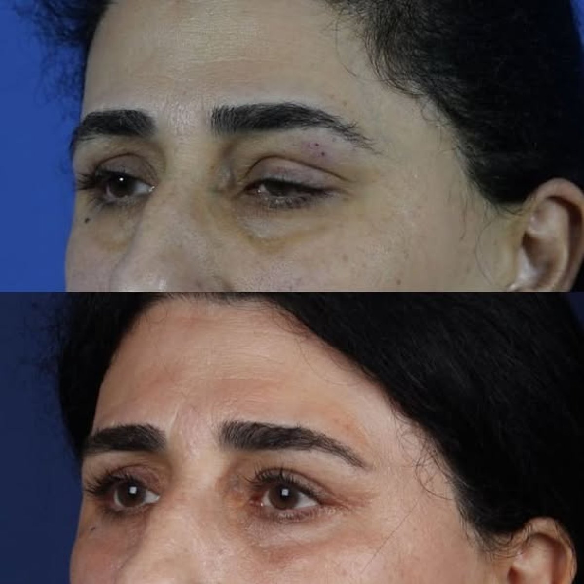 photo #1