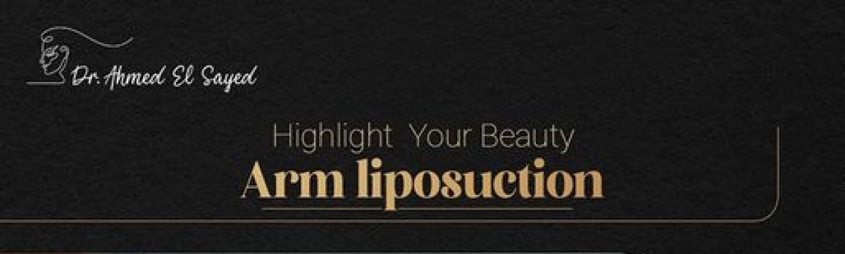Upper arm liposuction results at Dr. Ahmed El Sayed clinic – improved arm contour