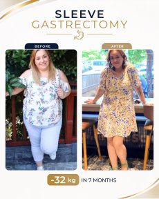 Standard Gastric sleeve surgery (Sleeve gastrectomy) All Included - photo 5