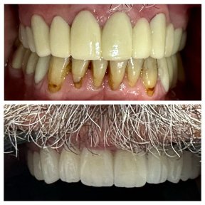 Premium Smile Makeover Package - photo 3