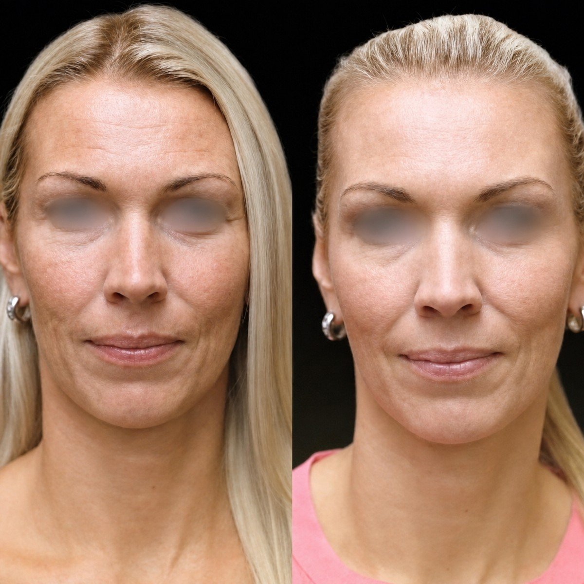 before and after photo