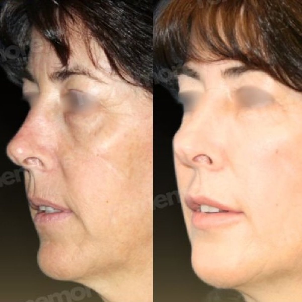 before and after photo