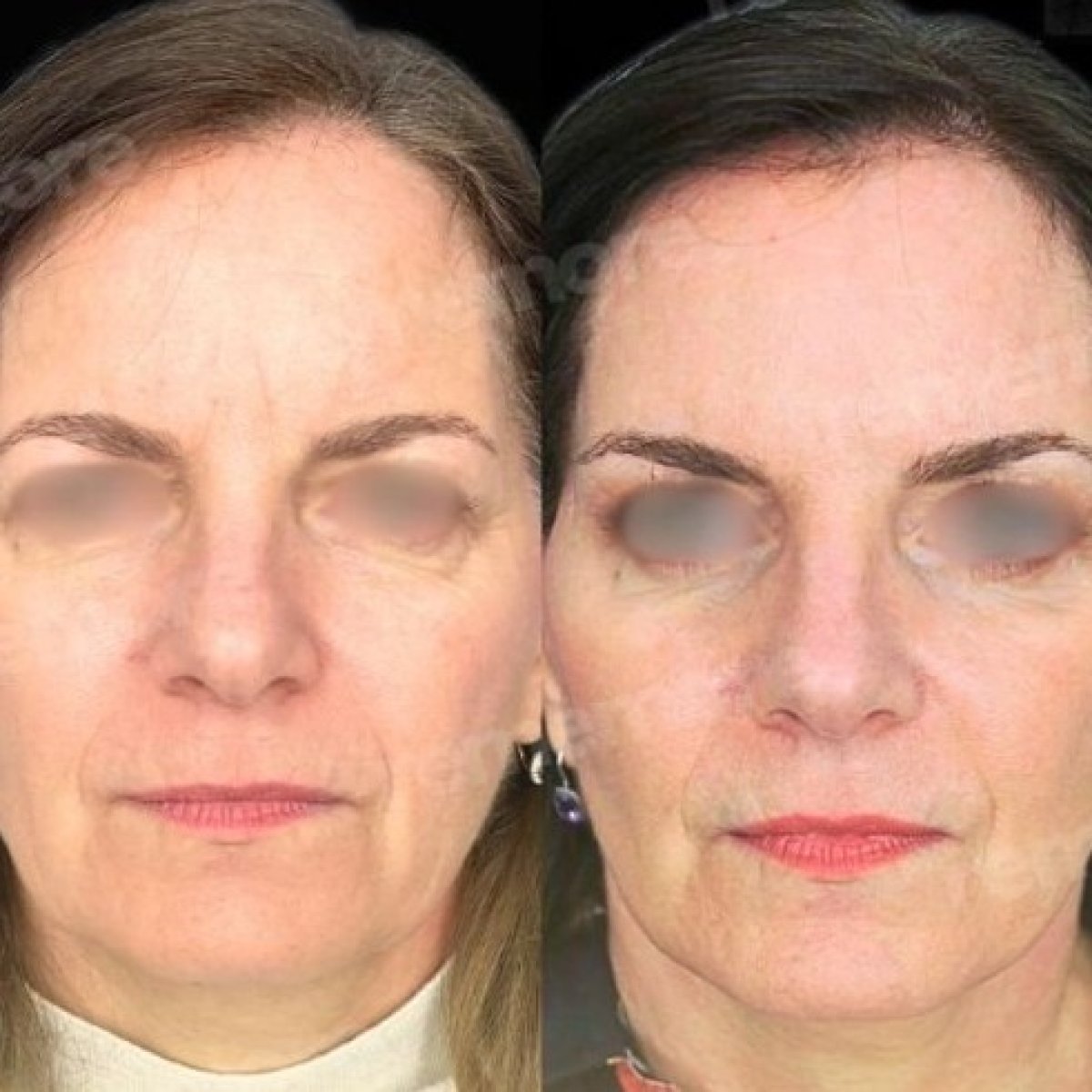 before and after photo
