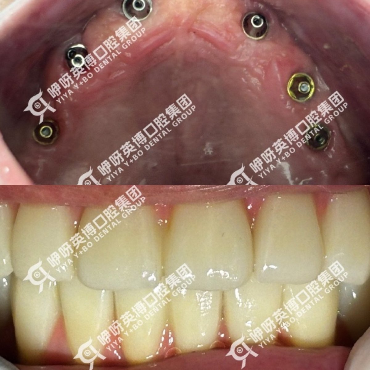 photo #1