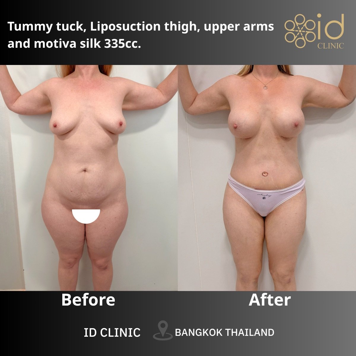 before and after photo