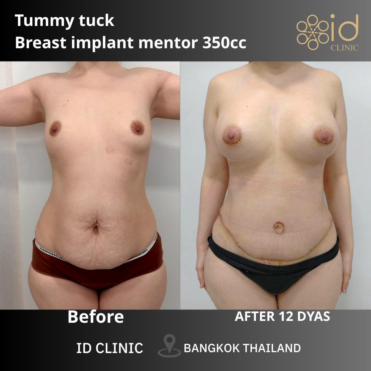 before and after photo