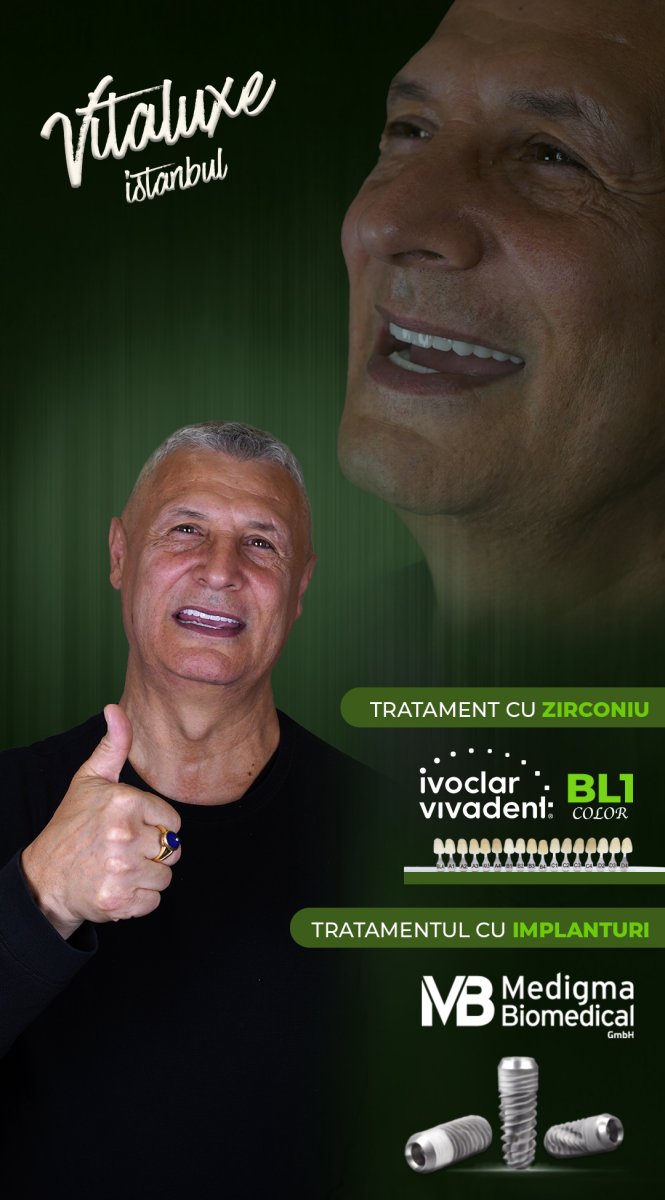 نتيجة زراعة الأسنان All-on-4 في Vitaluxe Istanbul – ابتسامة محسنة بتلبيسات الزركونيا