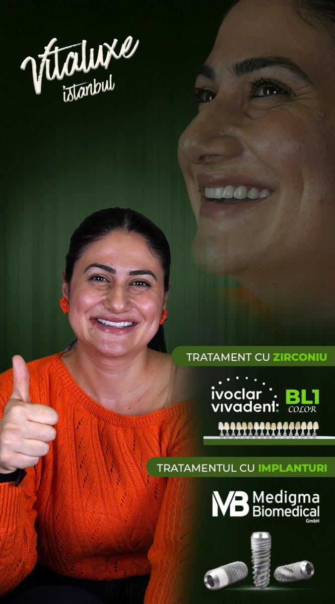 نتيجة زراعة الأسنان All-on-4 في Vitaluxe Istanbul – ابتسامة محسنة بتلبيسات زركونيا