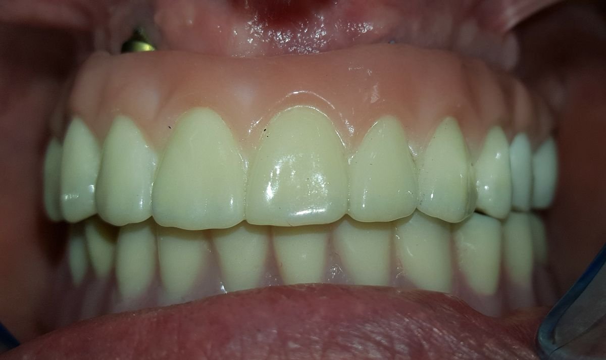 photo #2