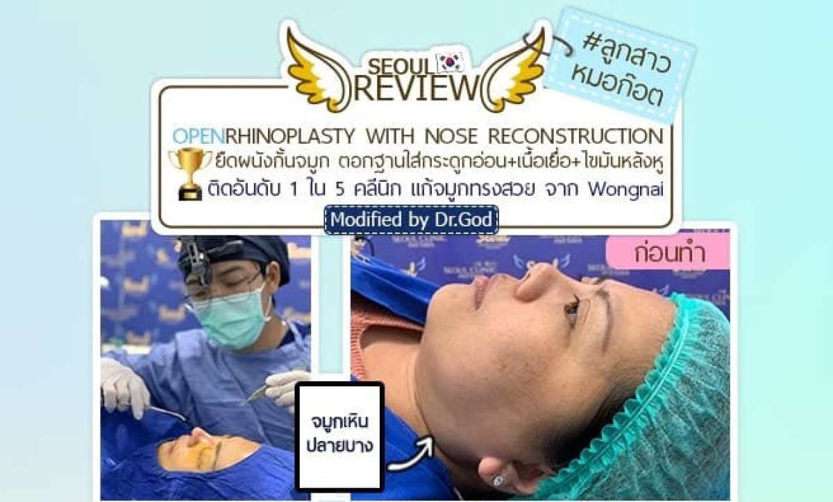 قبل عملية تجميل الأنف مع إعادة بناء الأنف في عيادة Seoul Review، نتيجة من الجانب
