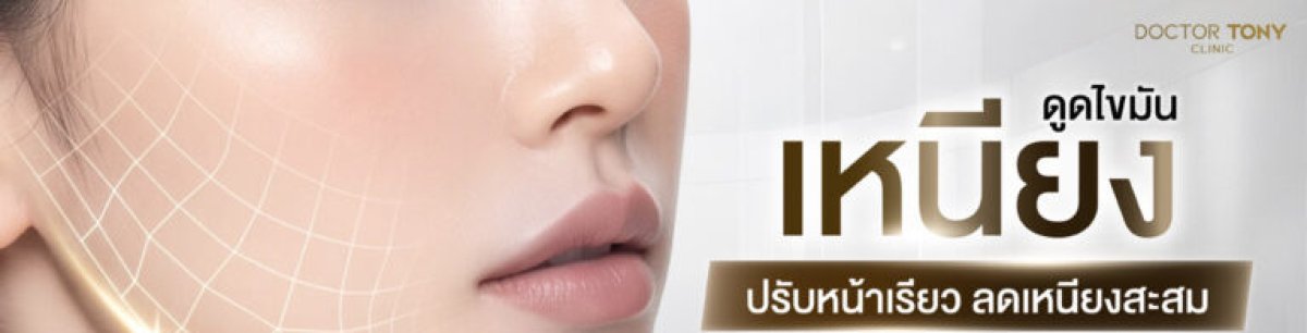 Chin liposuction result at Doctor Tony Clinic – improved jawline and reduced chin fat