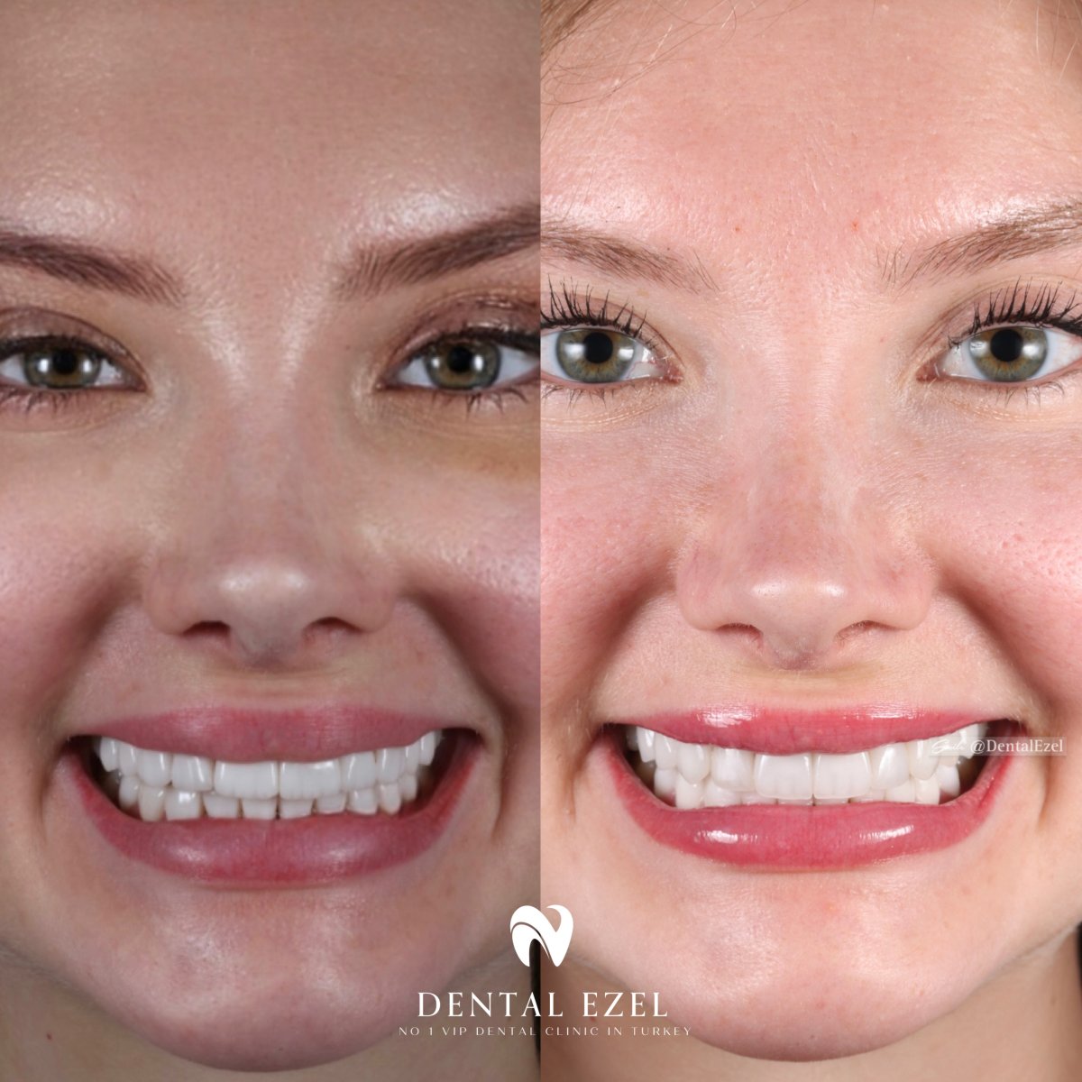 before and after photo