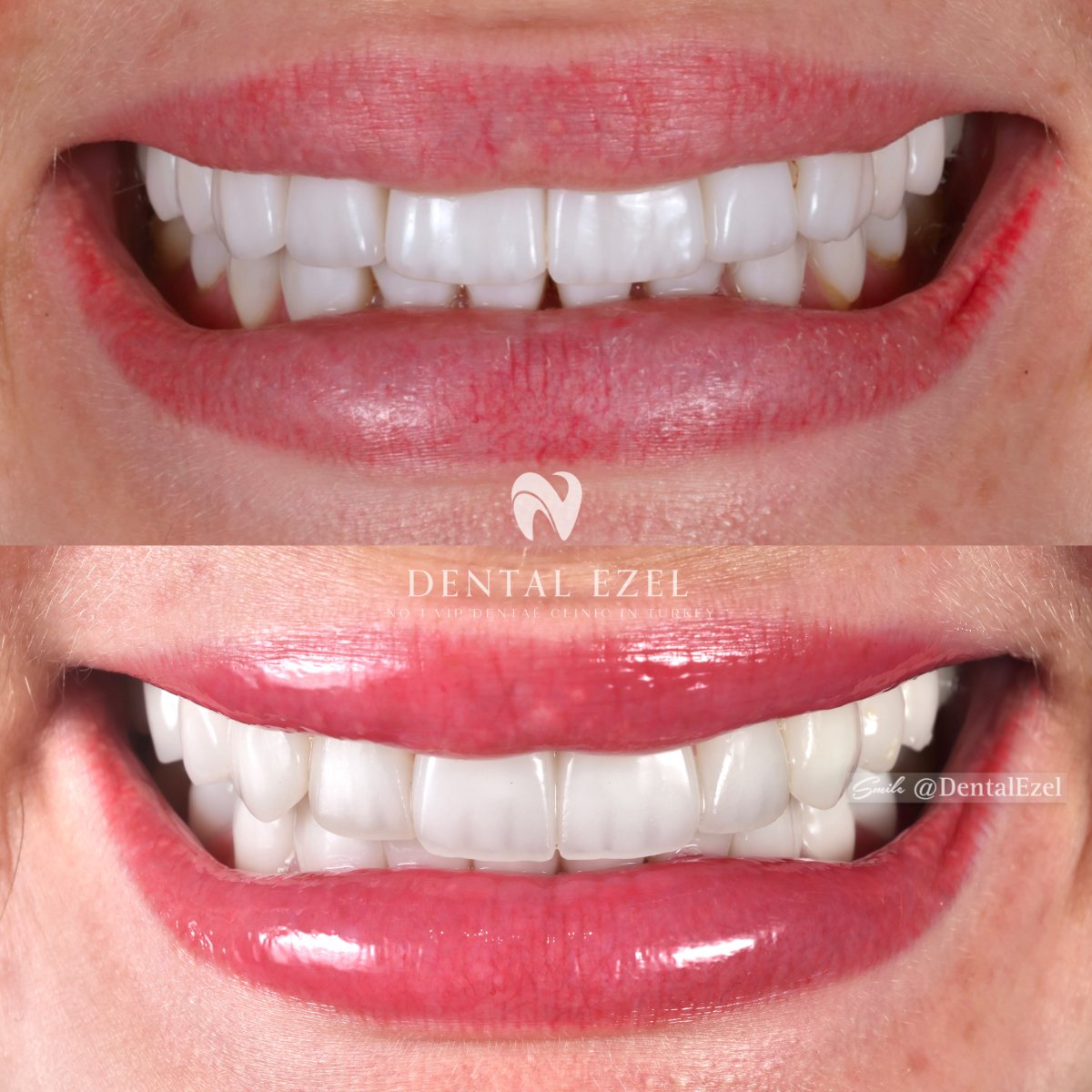 before and after photo