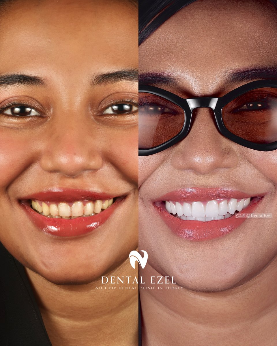before and after photo