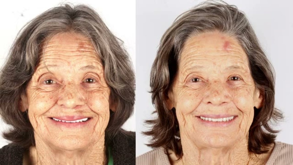 before and after photo