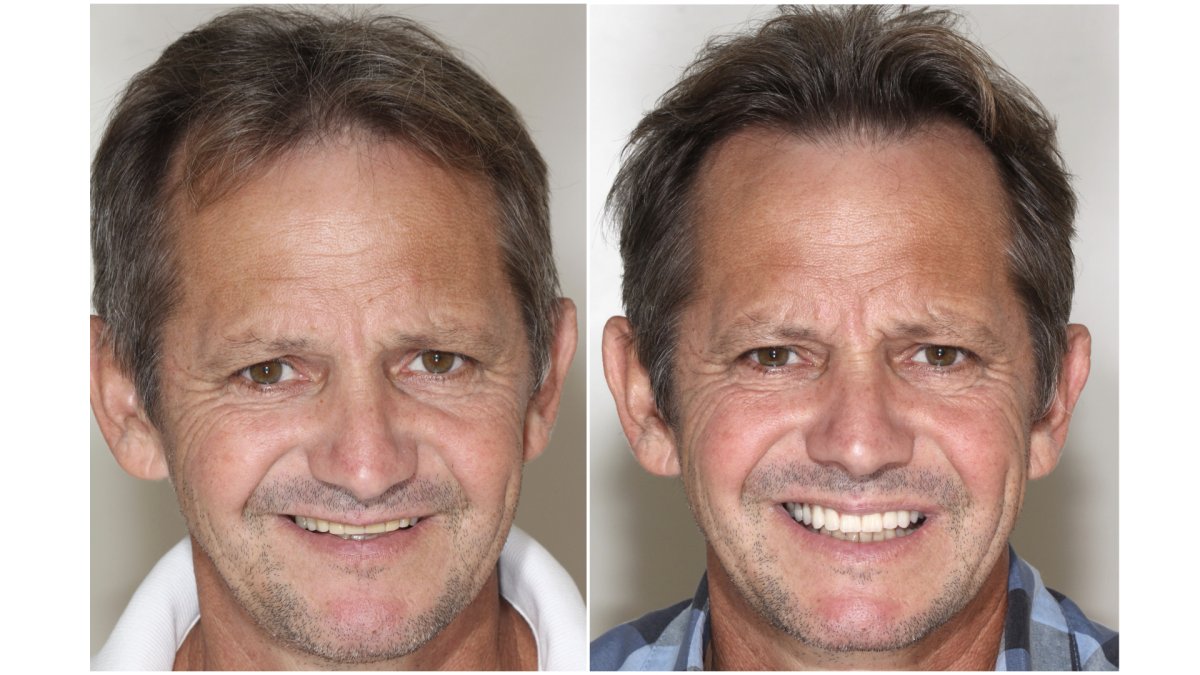 before and after photo