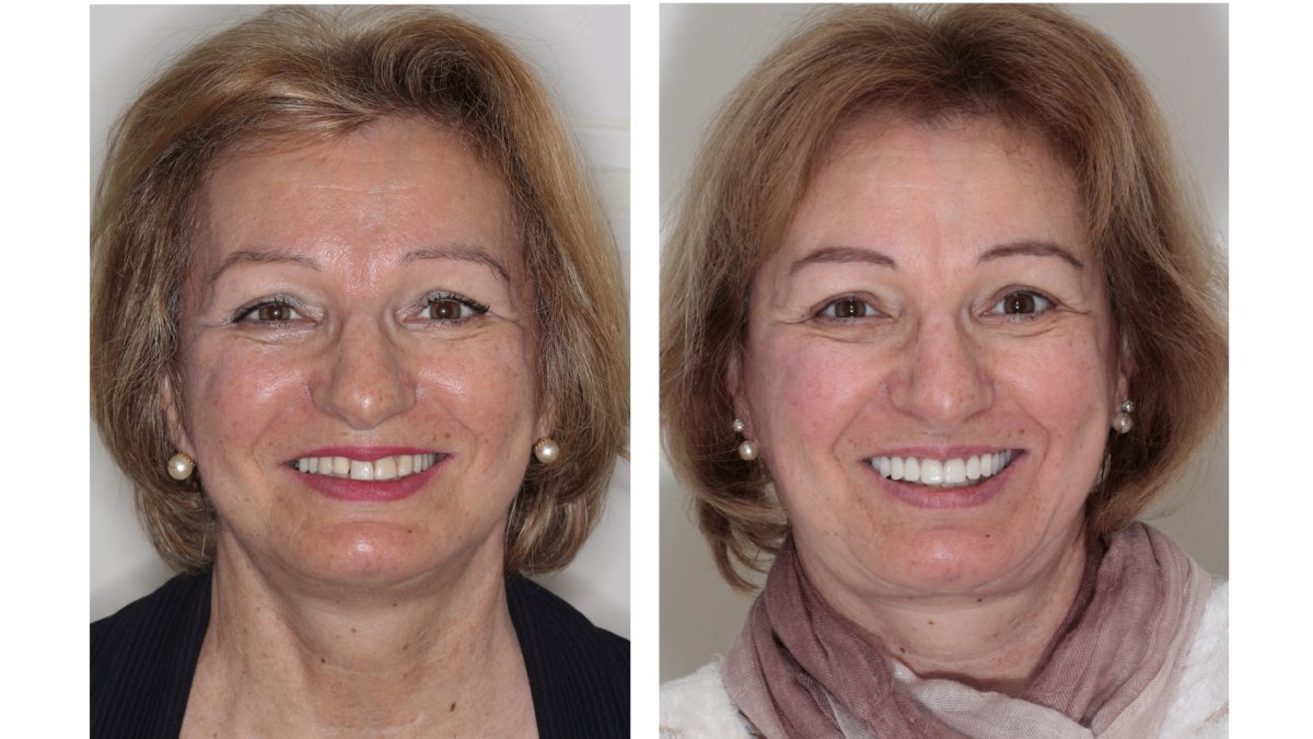 before and after photo