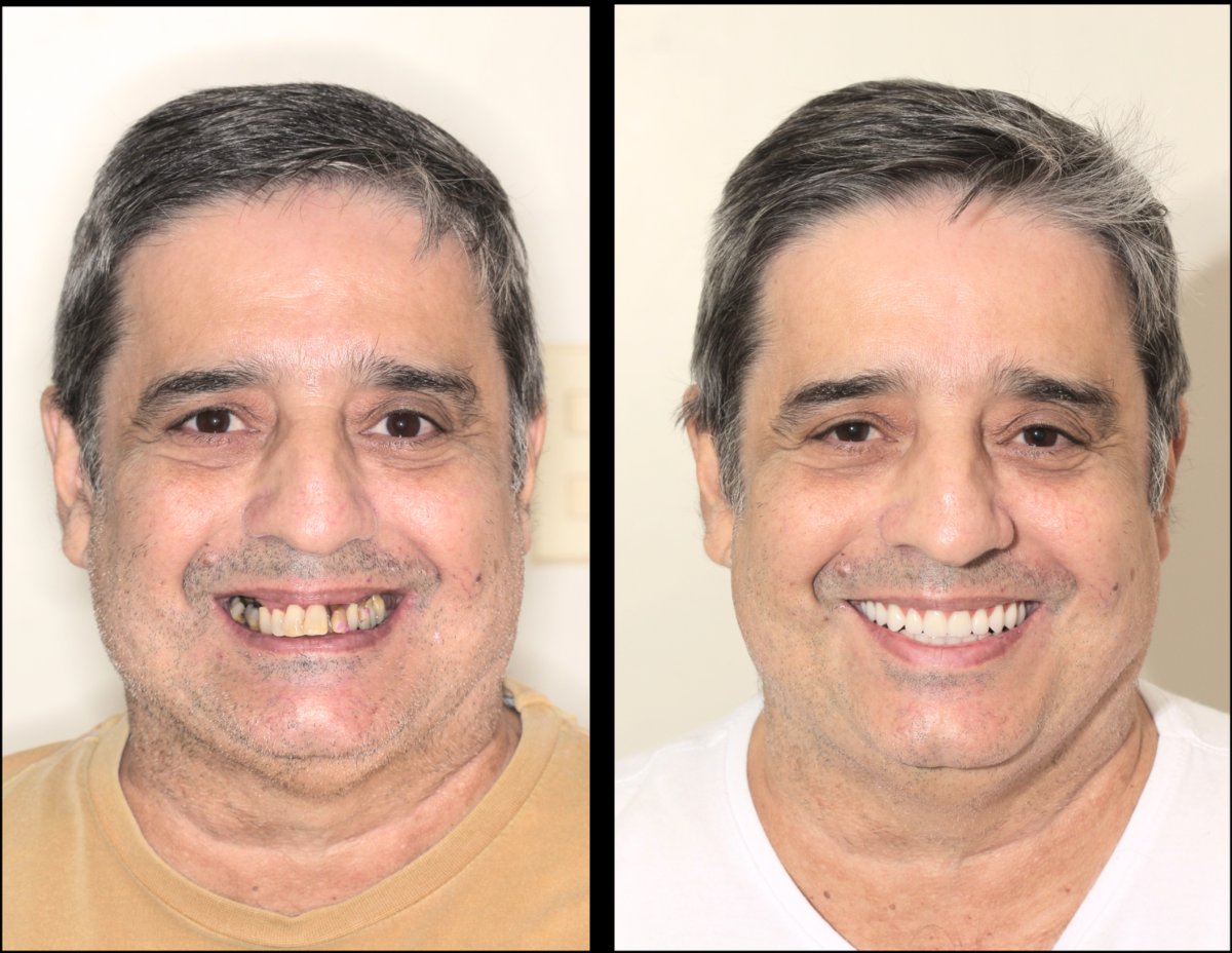before and after photo