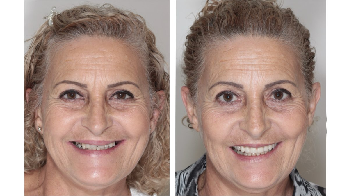 before and after photo