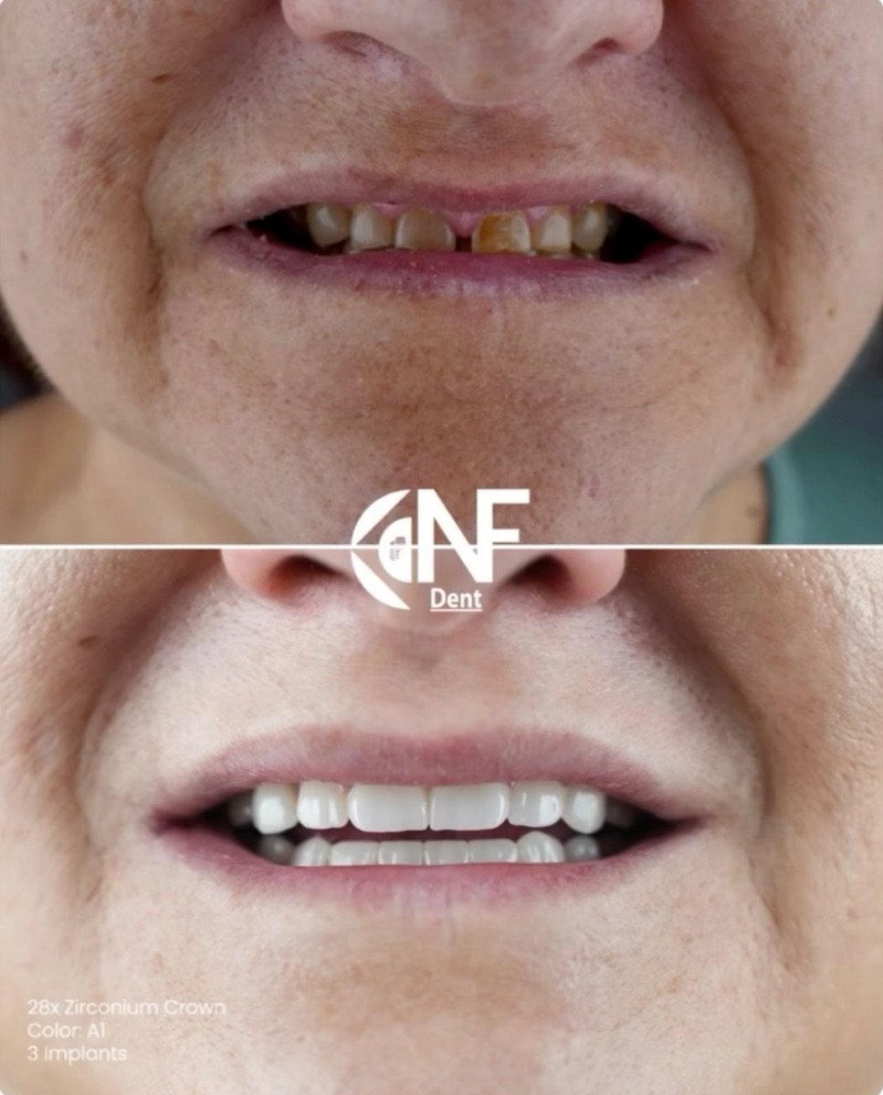 before and after photo