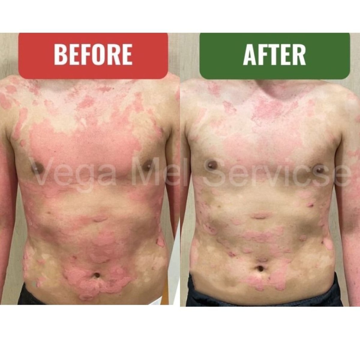 before and after photo