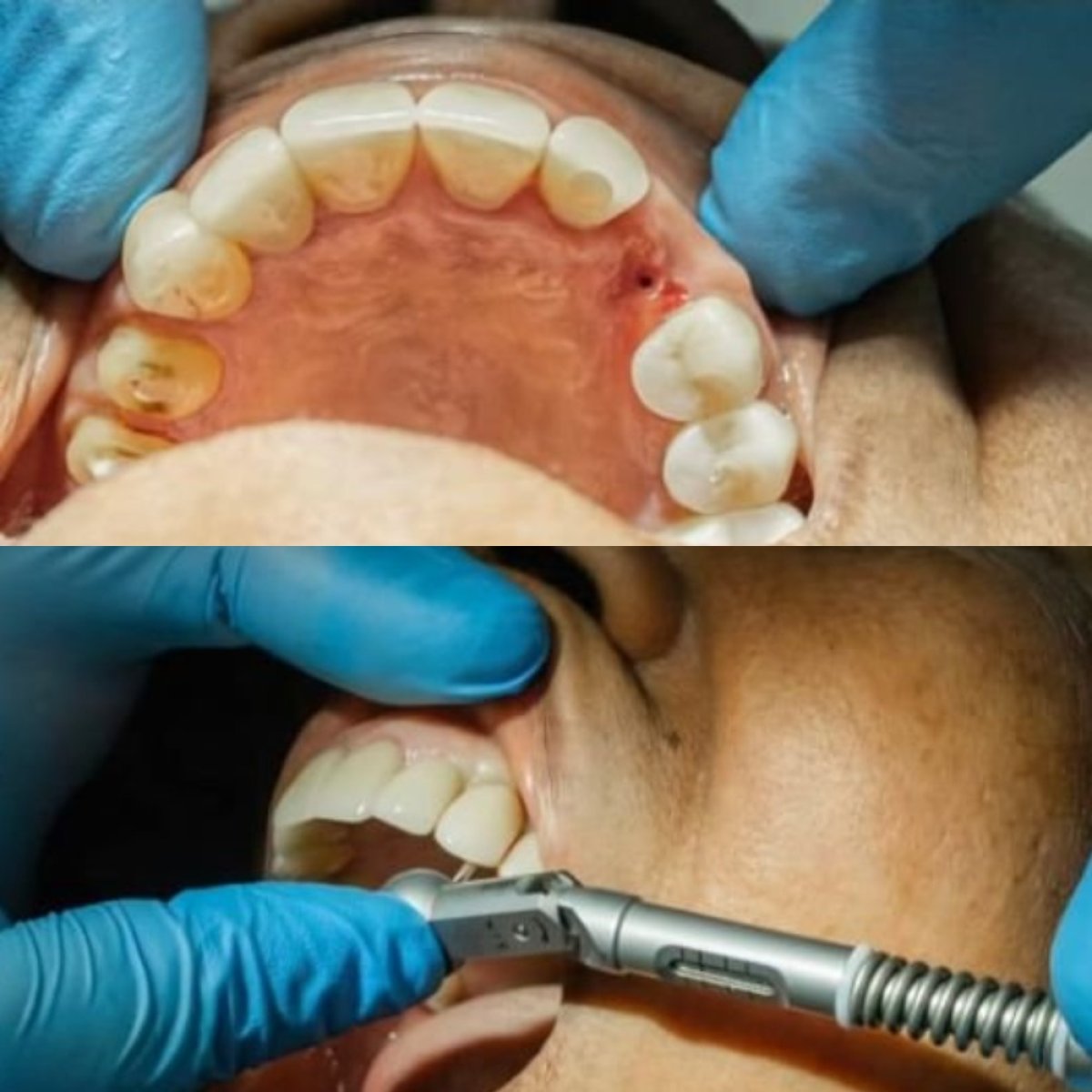 before and after photo