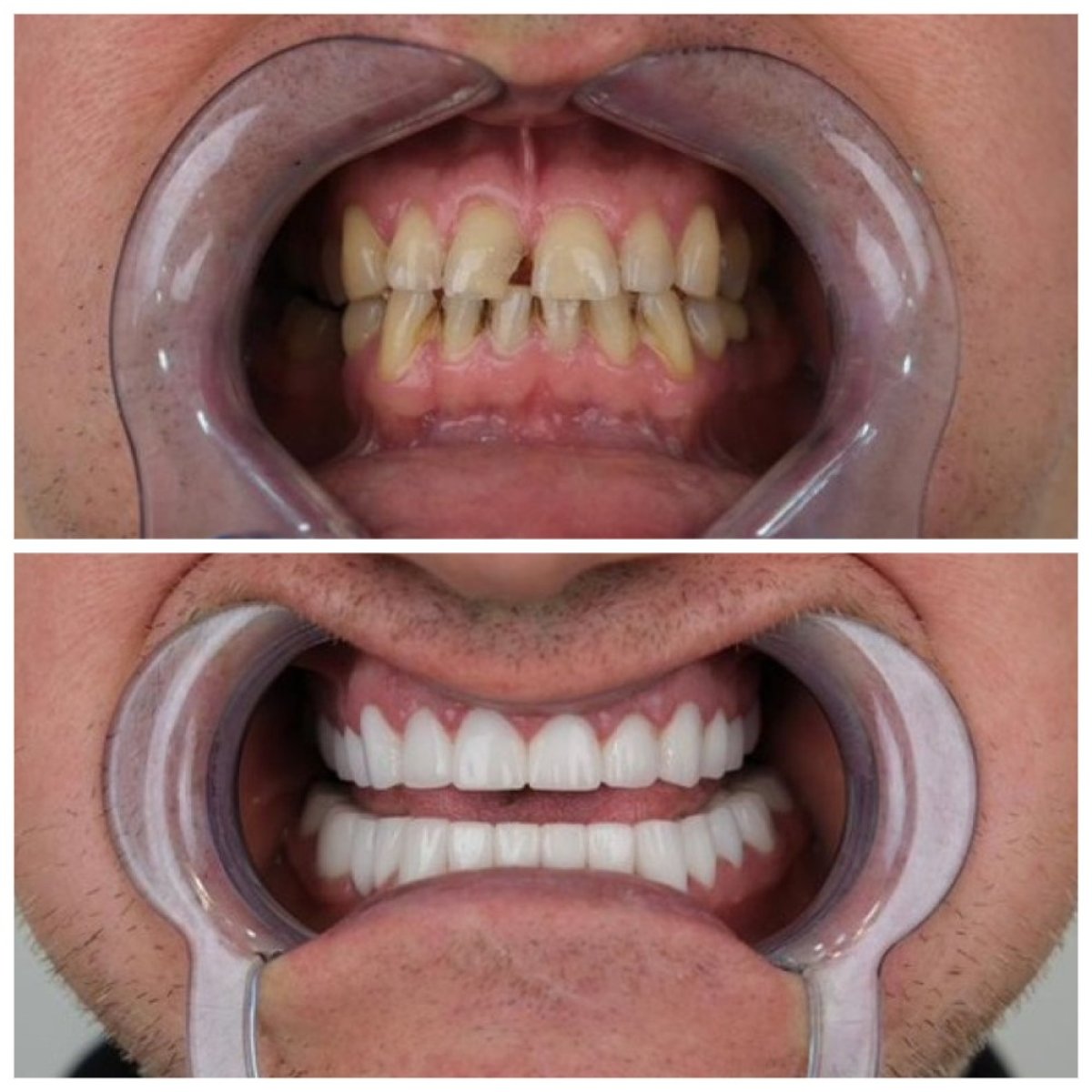 before and after photo