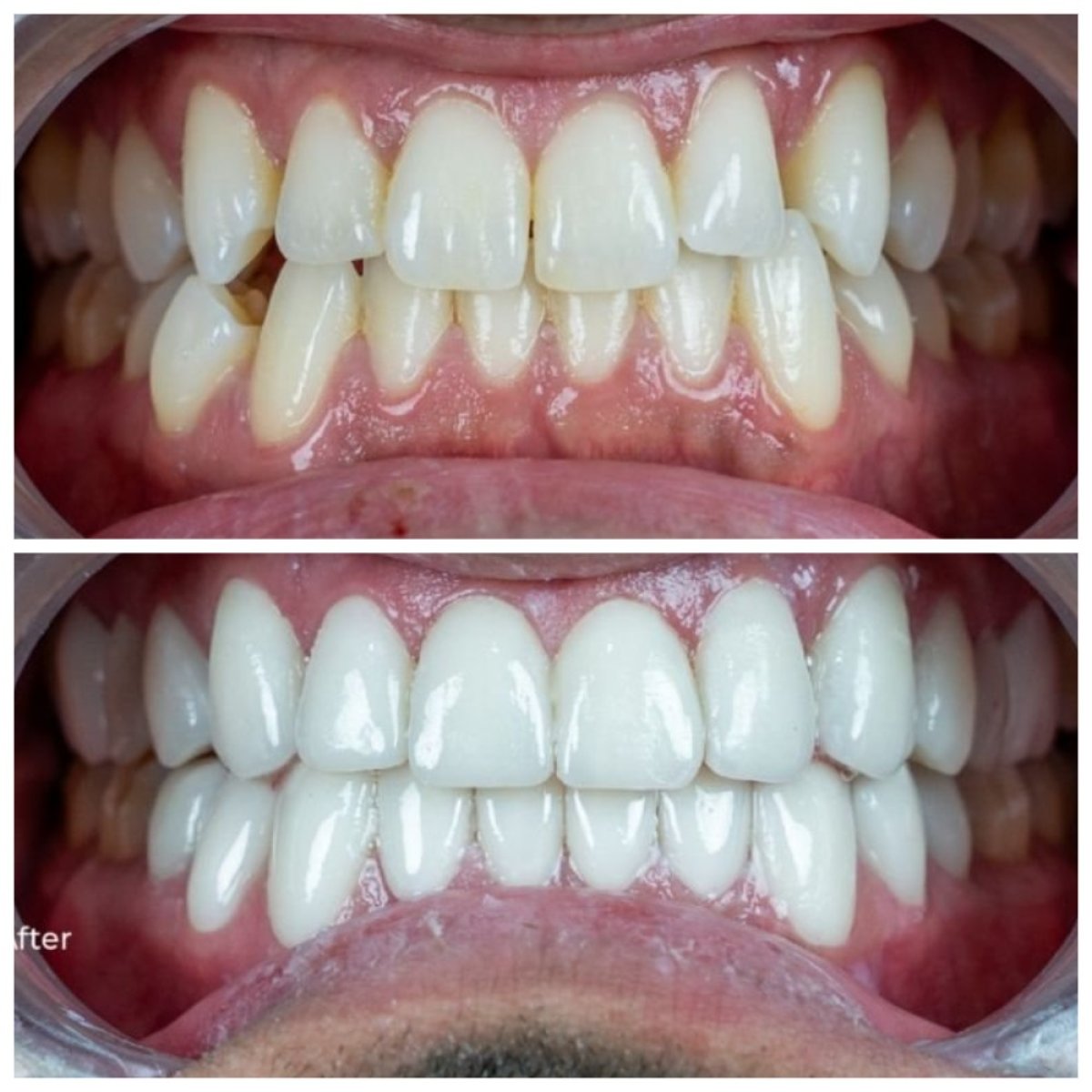 before and after photo