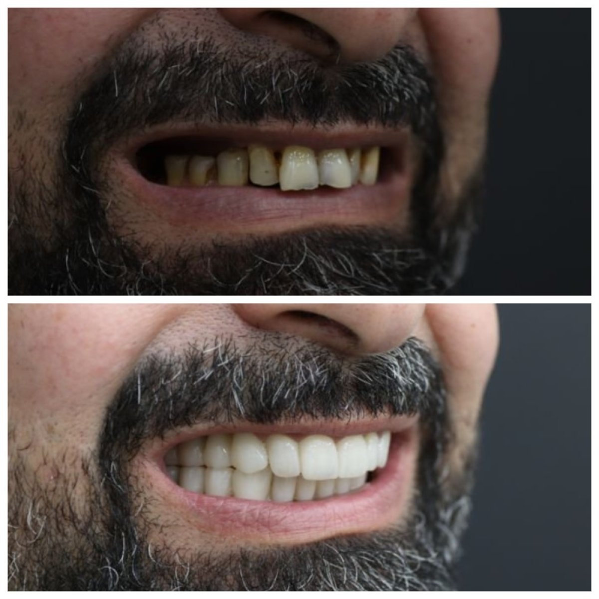 before and after photo