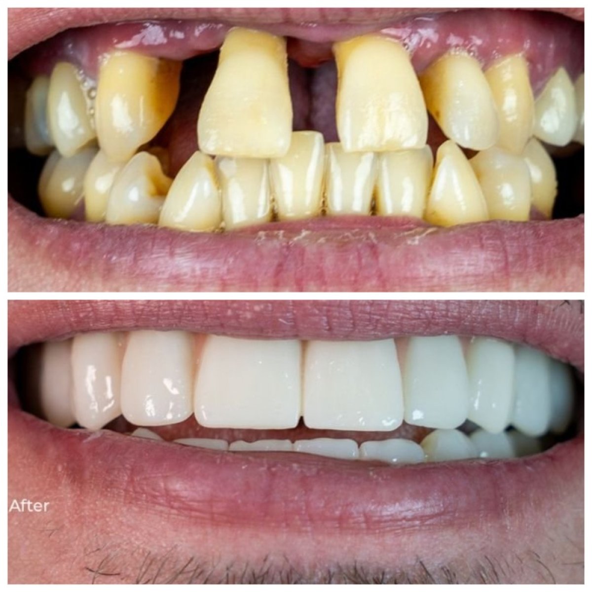 before and after photo